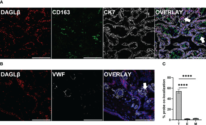 DAGLβ expression is mainly confined to trophoblasts. DAGLβ transcripts were detected in placental tissues using RNAscope® 2.5 HD RED assay. (A) DAGLβ transcripts detected in CK7 positive trophoblasts and CD163 positive placental macrophages. (B) DAGLβ mRNA was localized to VWF stained endothelial cells. Nuclei were counterstained with DAPI (blue). Arrowheads in merged micrographs indicate probe co-localization to different cell types. Magnification x40, Scale bar 100 µm. For quantitative determinations, ten images of four individual placentas were captured on Nikon A1 confocal microscope. Probe co-localization was quantified by Fiji software. (C) Relative distribution of DAGLβ transcripts to trophoblasts (T), endothelial cells (E) and placental macrophages (M) based on ISH signals (n=4). Statistical analysis was performed using one- way ANOVA, followed by Benjamini- Hochberg post hoc test (n=4). Representative stainings are shown in (A) and (B). Data are depicted in mean ± SEM; ****p < 0.0001.