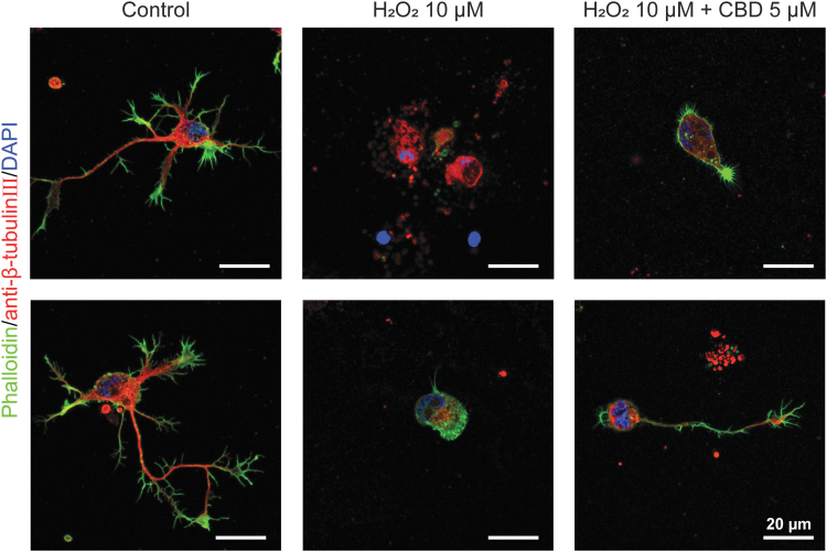 High-magnification CLSM images of hippocampal neurons after 24-h treatment of (middle) H2O2 (10 μM), and (right) H2O2 (10 μM), and CBD (5 μM). The cells were stained in green (F-actin), red (β-tubulin III), and blue (nuclei).