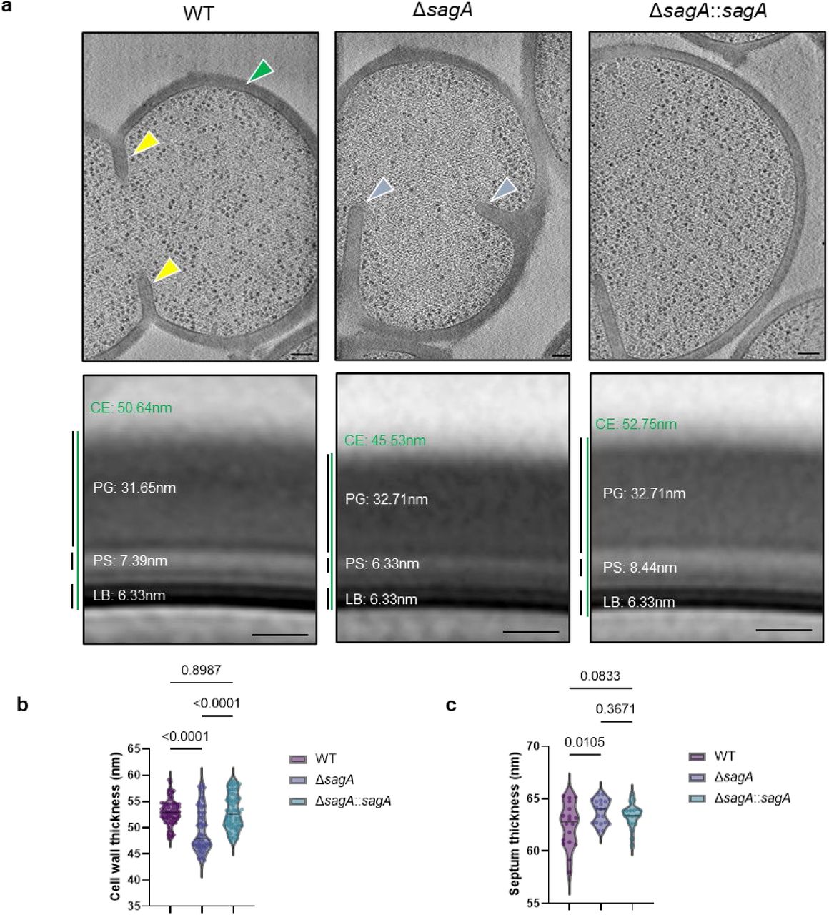 Ultrastructure of VREfm ERV165 strains.a, Top panel: representative cryo-electron tomographic (cryo-ET) slices of VREfm ERV165 strains. The cell wall is annotated with green arrows; normal septa are indicated with yellow arrows; and defective division septa are also marked with blue arrows. Images were acquired at a magnification corresponding to a pixel size of 2.638 Å (38,000×). Tomograms were 4× binned, resulting in a final pixel size of 10.55 Å. Scale bar, 100 nm. Bottom panel: subtomogram averages of the cell envelope of VREfm ERV165 strains were generated using Dynamo. Measured thicknesses of various envelope layers are indicated. Thickness measurements were derived from density plots of the subtomogram averages. Abbreviations: CE, total cell envelope; PG, cell wall; PS, periplasmic space; LB, lipid bilayer. Thickness measurements were obtained from density plots of the subtomogram averages (see Methods, Extended Data Fig. 2). Scale bar, 100 nm. b, Comparison of cell wall thickness. Data are shown as violin plots with dots representing individual data points and analyzed by one-way ANOVA with uncorrected Fisher’s LSD post-test, n=70. Grey horizontal lines represent median (WT: 52.93 nm, ΔsagA: 49.63 nm, ΔsagA::sagA: 53.01 nm). Grey dotted lines represent quartiles. c, Comparison of septum thickness. Data are shown as violin plots with dots representing individual data points and analyzed by one-way ANOVA with uncorrected Fisher’s LSD post-test, n=70. Grey horizontal lines represent median (WT: 62.48 nm, ΔsagA: 63.73 nm, ΔsagA::sagA: 63.40 nm).