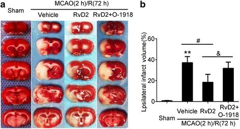 The rescue effects of RvD2 were reversed by GPR18 antagonist O-1918 after MCAO/R. a TTC-stained coronal sections from representative animals at 72 h after reperfusion. b Statistical analysis of infarct volumes. The infarct volume was expressed as a percentage of the ipsilateral hemispheric volume. Data were means ± SEM. *P < 0.05, **P < 0.01 vs. sham group, #P < 0.05, &P < 0.05, n = 6