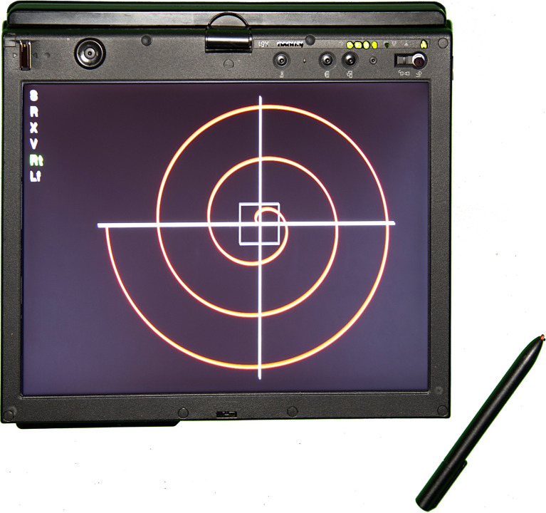 Photograph of the digital tablet used for collecting spiral drawings.