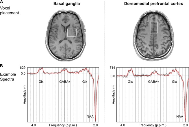 Magnetic resonance spectroscopy (MRS) representative voxel placement and example spectra. a MRS voxel of interest (outlined in white) in the basal ganglia and the dorsomedial prefrontal cortex. b Example spectroscopy spectra from each voxel. Glx glutamate + glutamine, GABA + γ-aminobutyric acid + macromolecules, NAA N-acetyl-aspartate, p.p.m parts per million