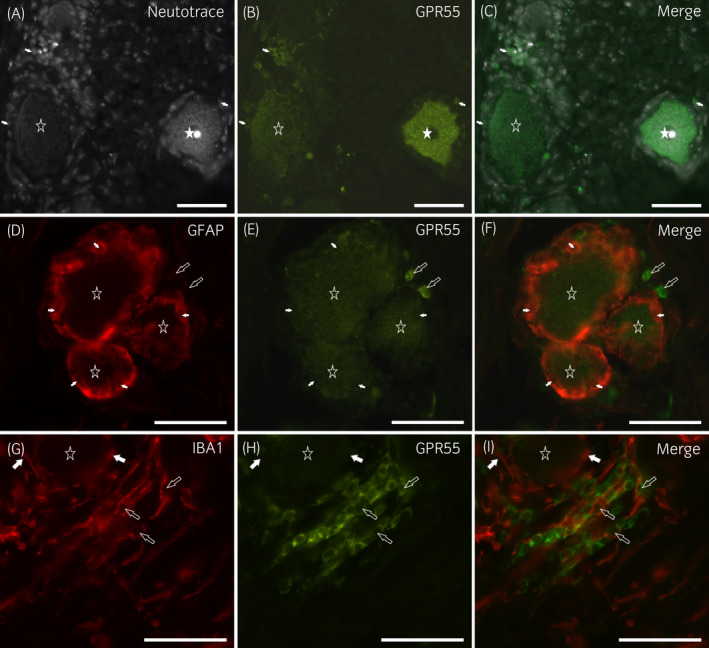 Photomicrographs of cryosections of a horse cervical (C8) dorsal root ganglion showing GPR55‐immunoreactivity (IR). (A–C) The white star indicates a sensory neuron expressing bright GPR55‐IR, whereas the open star indicates a neuron with weaker immunolabelling. The arrows indicate the nuclei of some perineuronal cells showing GPR55‐IR. (D–F) The stars denote three sensory neurons expressing weak‐to‐moderate GPR55‐IR. The white arrows indicate the nuclei of some satellite GFAP‐IR glial cells, which co‐expressed weak GPR55‐IR. (G–I) The star indicates one sensory neuron encircled by perineuronal cells expressing the microglia/macrophage marker IBA1 (white arrows). The open arrows indicate a few interneuronal IBA1‐IR macrophages which co‐expressed GPR55‐IR. Scale bar = 50 µm