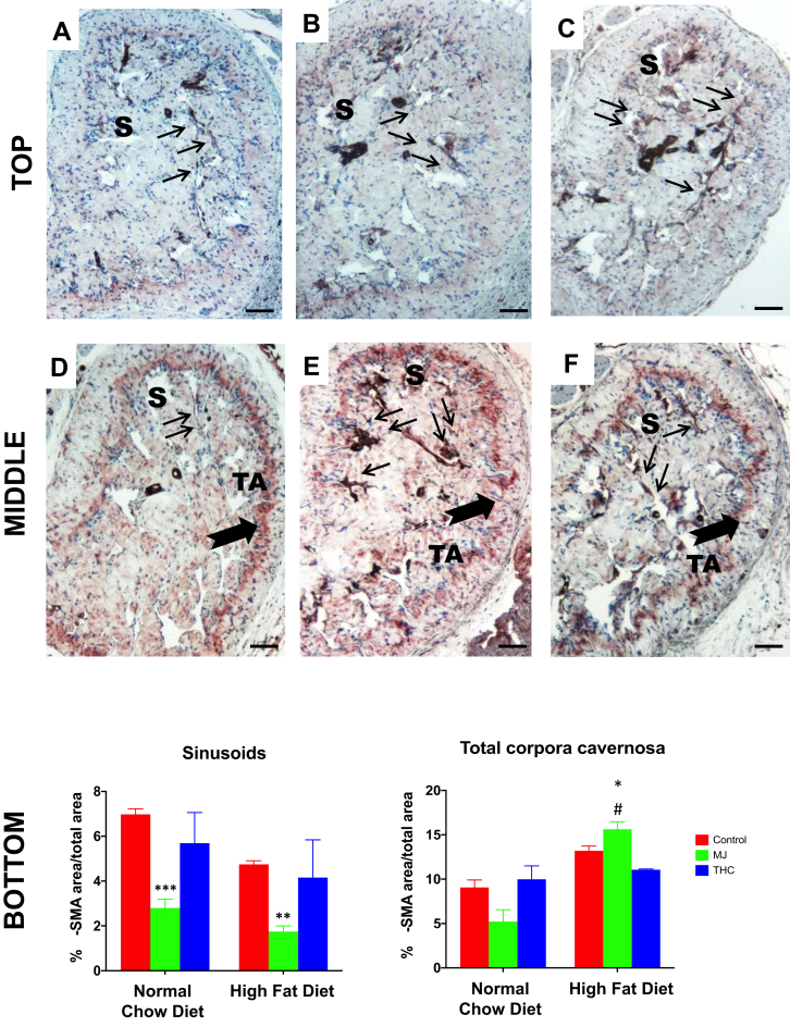 The effect of HFD and oral MJ extract on α-smooth muscle actin expression within the corpora cavernosa. Alpha smooth muscle actin antibody (α-SMA), a surrogate for myofibroblast expression, with AEC as chromogen and counterstaining with hematoxylin. Top panel: A: Control NCD; B: NCD + MJ; C: NCD + THC; Middle panel: D: Control HFD; E: HFD + MJ; F: HFD + THC. Bottom panel: QIA analysis of (α-SMA) determined at the level of the sinusoids and of the total corpora cavernosa. QIA results are expressed as %α-SMA IOD area/total area mean ± SEM: NCD + MJ vs control NCD (∗∗∗P < .001), HFD + MJ vs control HFD (∗∗P < .01) in the sinusoids; HFD + MJ vs control NCD or HFD (∗P < .05) and NCD + MJ vs HFD + MJ (#∗∗P < .05) in the tunica albuginea. Localization of α-SMA as demonstrated arrows. Thin arrows indicate the presence of myofibroblasts within the SMCs in the sinusoid (S) area. Thick arrows indicate the presence of myofibroblasts in the tunica albuginea (TA), which is pronounced in HFD groups. THC added to either NCD or HFD did not lead to significant changes in α-SMA expression at the sinusoid or tunica albuginea levels compared to control NCD or HFD. Magnification = 100×; 1 bar = 100 μm.