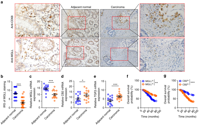 Expression of macrophage MGLL is decreased in carcinoma tissues and positively correlated to the survival of patients with CRC. a Representative images from immunohistochemical staining of CD68+ cells (macrophages) in adjacent normal tissue and carcinoma tissue. The corresponding area of infiltrated macrophages was stained with MGLL antibody on the consecutive slides. MGLL expression in macrophages in carcinoma was much lower than that in adjacent normal tissues. The representative areas of macrophages at higher magnification are displayed in the red square areas. The scale bar at higher magnification represents 50 μm and at lower magnification represents 200 μm. b The statistical data were obtained from immunohistochemical staining analysis of 30 samples from 30 patients. The data represent the means ± s.e.ms. (n = 30, ***P < 0.005, Student’s t-test). c–e The relative mRNA expression of MGLL (c), CB2 (d), and TGFβ (e) in macrophages from the carcinoma tissues or adjacent normal tissues. The macrophages were isolated from fresh carcinoma tissues or adjacent normal tissues from CRC patients who underwent surgery, and the macrophages were subjected to real-time PCR assays. The data represent the means ± s.e.ms. (n = 15, *P < 0.05, ***P < 0.005, Student’s t-test). f–g Overall survival of patients with CRC with differential expression of MGLL (f) or CB2 (g) in TAMs. The investigated patients were classified into two groups according to the mRNA expression of MGLL or CB2 in TAMs. The 50% of patients with high TAM MGLL or CB2 expression were assigned to group MGLLhi or CB2hi, respectively. The remaining patients with low TAM MGLL or CB2 expression were assigned to group MGLLlo or CB2lo, respectively. The overall survival time of the patients were obtained via follow-up visit (n = 53, **P < 0.01, ***P < 0.005, Gehan-Breslow-Wilcoxon test)