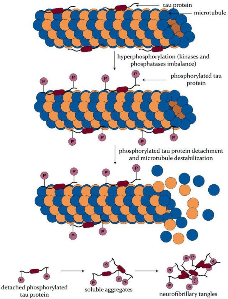 Schematic of the process of neurofibrillary tangle (NFT) formation. Under normal conditions, tau acts as a microtubule-associated protein. Aggregation-prone pathological tau becomes hyper-phosphorylated, ultimately leading to microtubule destabilization through dissociation. Soluble phosphorylated tau proteins come together to form NFTs. Figure is reproduced from Balasa, Adrian & Chircov, Cristina & Grumezescu, Alexandru. (2020). Body Fluid Biomarkers for Alzheimer’s Disease—An Up-To-Date Overview. Biomedicines. 8. 421. https://doi.org/10.3390/biomedicines8100421.