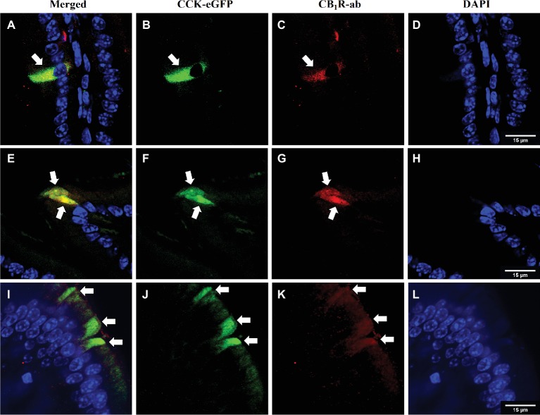 CB1Rs co-localize with CCK-containing cells in the upper small-intestinal epithelium. Immunohistochemical detection of eGFP [CCK-eGFP (B, F, J)] and CB1Rs [CB1R-ab (C, G, K)] reveals co-localization [merge (A, E, I)] in villi of intestinal epithelium. Arrows indicate separate enteroendocrine cells that contain immunoreactivity for CB1Rs that co-localize with CCK-eGFP cells. Representative images from three CCK-eGFP mice [DAPI stain (D,H,L)].