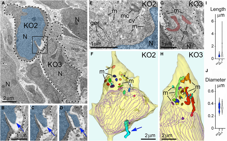 Adjacent herniated and non-herniated neurons show distinct ultrastructural characteristics of mitochondria(A) Low power micrograph of two neurons from the intermediate zone of CB1R−/− embryo, also shown in Figure 3 as cells number KO2 and KO3 (dotted lines designate their plasma membranes). Cell KO2 exhibits PNH whereas KO3 shows an intact nucleus.(B–D) Serial high power images of PNH from the framed area in (A). Notice the continuum of the chromatin stream (blue arrows) herniated from the nucleus (pseudo-colored blue) and penetrating the intercellular space as evidenced by the interruption of the plasma membrane (dotted lines) in (C) and (D). Scale bar in (B) is valid for (C) and (D).(E–H) High power images (E) and (G) and 3D reconstructions (F) and (H) of the cells KO2 and KO3. 20 randomly selected mitochondria from each cell are shown in different colors in the 3D reconstructions. Cell KO2 exposing PNH (blue arrow) contains mostly short or spherical mitochondria, whereas several mitochondria from cell KO3 are long, for example, the branching mitochondrion pseudo-colored in red in the electron micrograph (G) and 3D reconstruction (H). Nuclei profiles from every 4th serial section are traced in violet. Abbreviations: cv, cilial vesicle; ger, granular endoplasmic reticulum; m, mitochondria, mc, mother centriole; N, nucleus.(I and J) Estimation plots of lengths and diameters for mitochondria from cells KO2 and KO3. Violins of cell KO2 are colored blue. Horizontal lines in every violin indicate average length and diameter. For comparison of the estimation plots for mitochondria of all analyzed cells from CB1R−/− and control embryos see Figure S2.