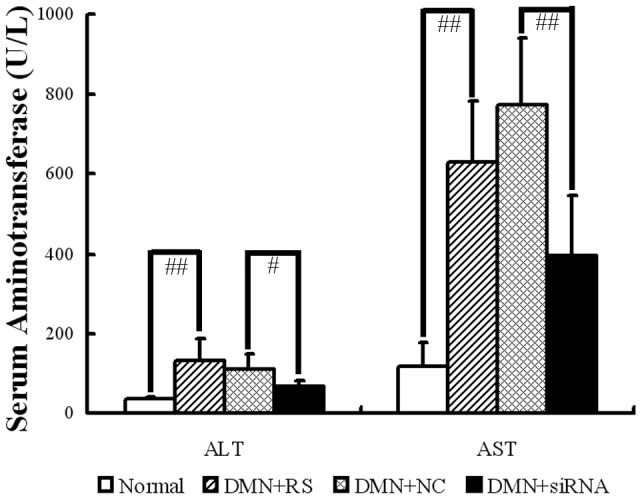 Effect of CB1-RNAi-LV on serum aminotransferase in DMN induced hepatic fibrosis.The statistical results of serum alanine aminotransferase (ALT) and aspartate aminotransferase (AST) levels in normal rats, rats with DMN treatment and Ringer's solution (RS) injected, rats with DMN treatment and NC-LV injected, rats with DMN treatment and CB1-RNAi-LV injected. “#” p<0.05 and “# #” p<0.01. The data demonstrated that serum ALT and AST elevated significantly in DMN rats as compared with the normal rats. However, CB1-RNAi-LV treatment markedly reduced the serum ALT and AST as compared with NC-LV treatment rats.