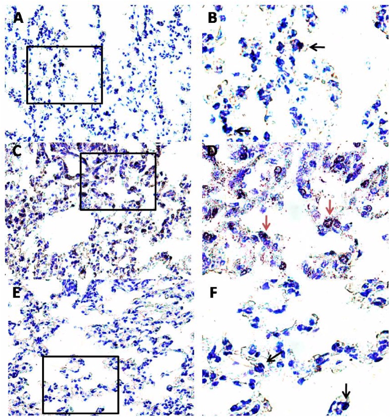 Effect of PEA on pulmonary mast cell recruitment and degranulation induced by OVA sensitization. PEA (10 mg/kg) was administered i.p. 15 min before each OVA administration. Mast cell recruitment and degranulation was evaluated by Toluidine blue staining in pulmonary sections obtained from OVA sensitized mice (C,D), OVA sensitized mice pre-treated with PEA (E,F) and control mice (A,B). Quiescent mast cells were dark blue stained (black arrows) while degranulated mast cells were red purple/violet stained (red arrows). (B,D,F) Are views at higher magnification (100×) of (A,C,E) (40×).