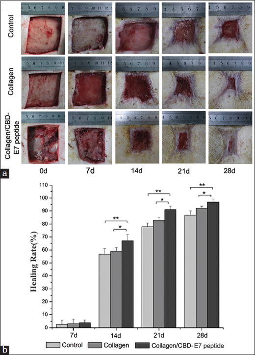 Wound size measurements at different time points. (a) The appearances of the wounds in the different groups at day 0, 7, 14, 21 and 28; (b) The statistical analysis of the healing rate in the different groups. 7 d: Collagen/CBD-E7 peptide: 3.96 ± 1.9%, Collagen: 3.15 ± 3.3%, Control: 2.52 ± 3.1%; 14 d: Collagen/CBD-E7 peptide: 67.04 ± 4.8%, Collagen: 59.11 ± 2.7%, Control: 56.76 ± 4.3%; 21 d: Collagen/CBD-E7 peptide: 90.96 ± 2.7%, Collagen: 82.96 ± 1.92%, Control: 77.98 ± 2.8%; 28 d: Collagen/CBD-E7 peptide: 96.90 ± 2.3%, Collagen: 92.05 ± 1.6%, Control: 86.93 ± 3.1%. The data are presented as the mean ± SD. **P < 0.01, *P < 0.05. CBD = collagen-binding domain. SD = standard deviation.