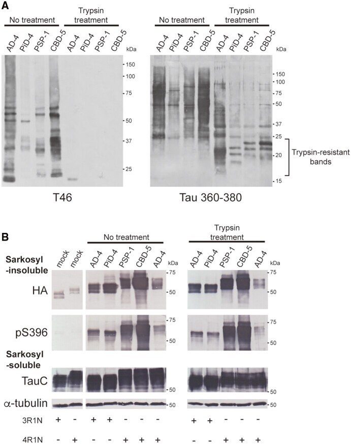 Prion-like seeding activities of trypsin-treated insoluble fractions of tauopathy cases in SH-SY5Y cells. (A) Immunoblot analyses of the sarkosyl-insoluble fractions before and after trypsin treatment. Full-length tau and C-terminal tau fragments were detected with T46 antibody. Trypsin-resistant tau bands were detected with tau 360–380 antibody. Full-length blots are presented in the Supplementary material. (B) The untreated and trypsin-treated insoluble fractions were introduced into SH-SY5Y cells transiently expressing HA-tagged human tau 3R1N or 4R1N. Immunoblot analyses of sarkosyl-insoluble fractions and sarkosyl-soluble fractions extracted from mock-transfected cells, and cells with introduced untreated or trypsin-treated tau seeds. Insoluble tau was detected with anti-HA and pS396 antibodies. Total tau was detected with TauC antibody. Full-length blots are presented in the Supplementary material.