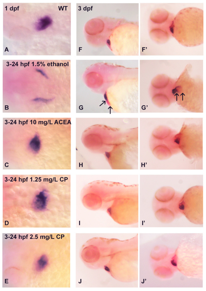 Effects of ethanol and cannabinoid exposure on the expression of cmlc2 in embryonic zebrafish heart. Compared to the cmlc2 expression in untreated embryos ((A), dorsal view, (F,F’) lateral view), only exposure to 1.5% ethanol disrupts the normal cmlc2 cardiac expression pattern ((B,G,G’), arrows) in 1 dpf and 3 dpf embryos. No effects of cannabinoid exposure on cmlc2 expression were observed at any concentrations of these agonists (C–E,H–J,H’–J’). Each experiment was conducted in triplicate with an n = 20, with 60/60 embryos showing a normal cmlc2 expression pattern with no treatment or cannabinoid agonist exposure, and 0/60 embryos showing a normal cmlc2 expression pattern with ethanol exposure.