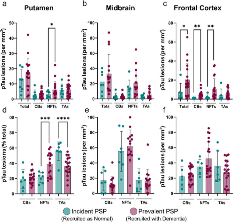 Incident and prevalent PSP cases differ in regional tau lesion density and lesion subtype composition.Quantification of pTau-positive cellular lesions in incident PSP and prevalent PSP across selected brain regions and lesion classes. Incident PSP cases are shown in teal and prevalent PSP cases in magenta. Bars represent group means with error bars indicating standard deviation, individual points represent individual cases. Regional densities of total pTau-positive cells, coiled bodies (CBs), neurofibrillary tangles (NFTs), and tufted astrocytes (TAs) are shown for the putamen (a), midbrain (b), and frontal cortex (c). In the frontal cortex, prevalent PSP showed increased total pTau-positive lesion density, accompanied by higher CB and NFT densities (c). Lesion subtype compositions, expressed as the percentage of total pTau-positive cellular pathology, are represented in panels (d-f), illustrating the relative contribution of CBs, NFTs, and TAs. These analyses showed greater NFT burden in prevalent PSP and greater TA burden in incident PSP within the putamen (d). Brackets indicate between-group comparisons; * = P < 0.05,* = P < 0.01,*** = P < 0.001, **** = P < 0.0001.