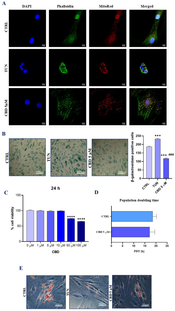 Evaluation of morphology, proliferation rate, and adipogenic differentiation of ASCs affected with tunicamycin and treated with CBD. ASCs were incubated with CBD 5 µM concentration before exposition to tunicamycin for 24 h. Morphological changes for cells pretreated with CBD 5 µM and with no treatment were estimated with confocal microscopy. ASCs were stained with DAPI, phalloidin, and MitoRed (A). Cellular sentence was measured using β-galactosidase. Statistical plots show statistical significance with asterisks and hashtags (B). Proliferation rate was measured with TOX-8 resazurin-based assay after 24 h incubation with different CBD concentrations (C). PDT was determined for CBD 5 µM (D). Correlation between lipid overload and CBD pretreatment in tunicamycin-treated ASCs was estimated with Oil Red O stain and observed with brightfield microscopy (E). The ability to form colonies for pretreated cells was estimated using a clonogenic test. CFU-Fa (cell colony formation) differences between groups are shown in diagram (F). Relative expression was measured and visualized with graphs. Immunostaining of CTRL, TUN, and CBD5µM with Ki-67 atto 594 antibody and DAPI was observed under a confocal microscope. (G). Mi-101-1/2 (H) and miR 17-5p (I) expression levels are shown on graphs. Cells were visualized 0 h, 6 h, 24 h, and 48 h after scarring. The black vertical lines show the edges of the scar, while the arrows show the confluence of the scar (J). Asterisk (*) refers to a comparison of groups treated with tunicamycin (TUN) and CBD (CBD 5 µM) to untreated healthy cells (CTRL). Hashtag (#) refers to comparison of group treated with CBD (CBD 5 µM) to group treated with tunicamycin (TUN). */# p < 0.05, **/## p < 0.01, ***/### p < 0.001, ****/#### p < 0.0001 while non-significant differences are not marked. Statistics were performed by one-way ANOVA test.