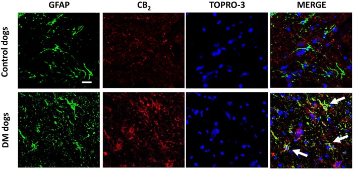 Double immunofluorescence analysis for CB2 receptor and GFAP in spinal cord sections of DM-affected dogs. Representative photomicrographs showing double immunofluorescence analysis for the CB2 receptor and GFAP, using TOPRO-3 for labelling cell nuclei, in the grey matter of the ventral horn in T7-T10 spinal cord sections of DM-affected and age-matched control dogs (n=3/group). Scale bar: 50 µm. Arrows indicate cells labelled with the antibodies for the two markers.