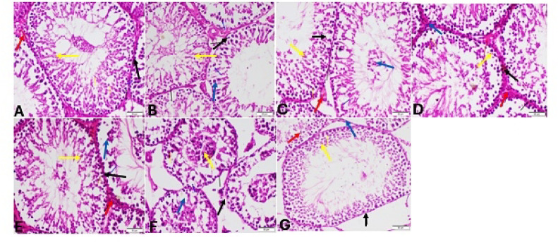 Testis sections stained by H&E, for trained rats. (A) Control group showing normal histological structure of testis intact seminiferous tubule (black arrow), normal germinal layers (yellow arrow) and normal Leydig cell (red arrow). (B, C), Stanz group intact seminiferous tubules (black arrow), regular arrangement of all germinal layers and healthy spermatids (yellow arrow), as well as degeneration of spermatogenic cells (blue arrow). (C) Showing intact seminiferous tubules (black arrow), regular arrangement of all germinal layers and healthy spermatids (yellow arrow), congested blood vessel (red arrow), degeneration of spermatogonia (blue arrow). (D, E) Cann group (D): Showing intact seminiferous tubules (black arrow), hyperplasia of Leydig cell (blue arrow), oedema (red arrow), degeneration of spermatogonia (yellow arrow), (E): Showing intact seminiferous tubules (black arrow), regular arrangement of all germinal layers and healthy spermatids (yellow arrow), oedema (red arrow), degeneration of spermatogonia (blue arrow) (F, G) combined group. (F) distortion of seminiferous tubules (black arrow), exfoliation into the tubular lumen (yellow arrow), vacuolation of Sertoli cells (blue arrow) (G): showing mild distortion of seminiferous tubules (black arrow) and organization of the seminiferous epithelium (yellow arrow), degeneration of some germ cell (red arrow) and atrophy of Leydig cells (blue arrow)