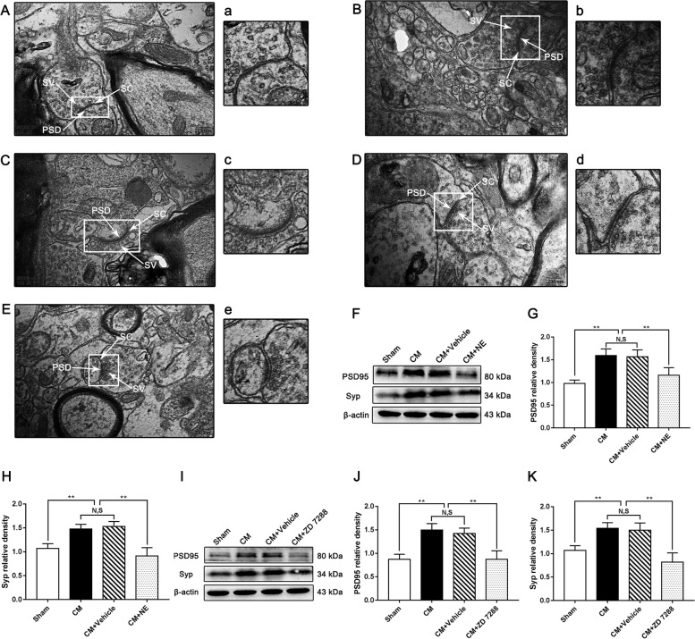 Regulation of synaptic plasticity by NE or ZD 7288 in the PAG of CM rats. A-E Synaptic ultrastructure in the four groups. A, a: Sham group; B, b: CM group; C, c: CM + Vehicle group; D, d: CM + NE group; E, e: CM + ZD 7288. PSD, postsynaptic density; SC, synaptic cleft; SV, synaptic vesicle. a-e show enlarged versions of the images in A-E. (Scale bars = 200 nm). F and I Representative western blots of PSD95 and Syp. G and H The protein levels of PSD95 and Syp in the CM group were drastically higher than those in the Sham group, and there was no significant difference between the CM group and CM + Vehicle groups. The PSD95 and Syp expression levels in the CM + NE group were seriously reduced compared with those in the CM + Vehicle group. (n = 6/group, **p < 0.01, N, S, not significant). J and K The protein levels of PSD95 and Syp were substantially higher in the CM group than those in the Sham group, and there was no statistical difference between the CM group and CM + Vehicle groups. Compared to the CM + Vehicle group, the levels of PSD95 and Syp were robustly decreased in the CM + ZD 7288 group. (n = 6/group, **p < 0.01, N, S, not significant)