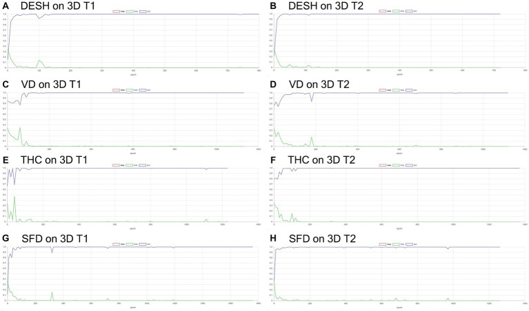 Results of training for deep learning of the image classification. The accuracy (blue line) and loss (green line) for the detection of disproportionately enlarged subarachnoid space hydrocephalus (DESH: A,B), ventricular dilatation (VD: C,D), tightened sulci in the high convexities (THC: E,F), and Sylvian fissure dilation (SFD: G,H) on 3D T1-weighted (A,C,E,G) and T2-weighted MRIs (B,D,F,H).