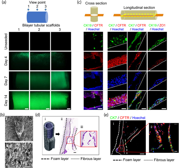 Human chemically derived hepatic progenitor cells (hCdHs) can engraft, survive and differentiate toward biliary epithelial lineage inside artificial bile duct construct. (a, c) Schematic diagrams at the top indicate section orientation. (a) Immunofluorescence images of staining with Calcein‐AM. 3D tubular scaffolds were seeded with hCdHs and cultured in cholangiocyte differentiation medium for 4, 7, and 14 days. Note progressive accumulation of green fluorescence signal through entire inner surface area of 3D scaffold indicative of successful epithelization. Unseeded scaffolds were used as negative control. Scale bar: 500 μm. (b) Scanning electron microscopy (SEM) images show that densely packed cells are lining only inner fiber layer (i) and are absent in outer layer (ii). Scale bars: 200 μm. (c). Double immunofluorescence staining for CK19, CK7, CFTR, and ZO‐1 at 14 days. Scale bars: 250 μm (cross section), 50 μm (longitudinal section). (d) H&E staining of 3D artificial bile duct in vitro. Scale bars: 400 μm (ii), 50 μm (iii). (e) Double immunofluorescence staining with CK7 and CFTR of 3D printed bile duct in vitro using slide scanner. Scale bars: 400 μm (i), 50 μm (ii)