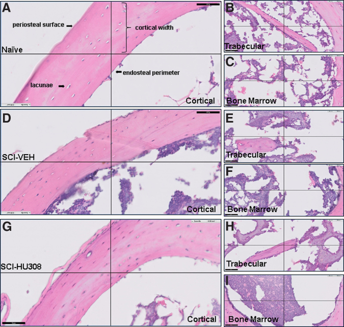 Representative histological staining of decalcified proximal tibiae from mice evaluated at 3 months post-injury plus 30 days of delayed treatment. Photomicrograph of H&E staining of cortical bone in (A) naïve, (D) SCI-VEH, and (G) SCI-HU308 animals. Photomicrograph of H&E staining of trabecular bone in (B) naïve, (E) SCI-VEH, and (H) SCI-HU308 animals. Photomicrograph of H&E staining of bone marrow in (C) naïve, (F) SCI-VEH, and (I) SCI-HU308 animals. Images obtained using a Philips Slide Digitizer. Bar represents 50 μm. Periosteal surface and resorption pits in cortical region are labeled. H&E, hematoxylin and eosin; SCI, spinal cord injury; VEH, in vehicle.