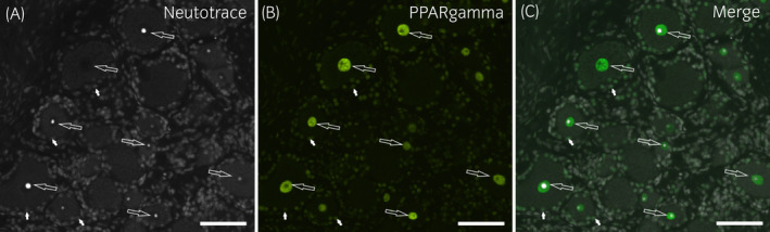 Photomicrographs of cryosections of a horse cervical (C8) dorsal root ganglion showing PPARγ‐immunoreactivity (IR). Bright PPARγ‐IR was expressed by neuronal nuclei (large arrows), whereas the nuclei of the glial cells (small arrows) showed weaker immunolabelling. Scale bar =50µm