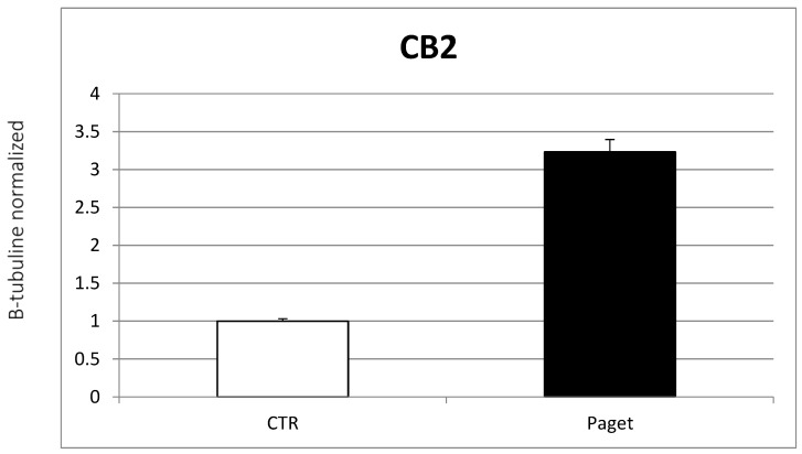 Comparison between CB2 protein expression at Western blotting from 2 OCs of subjects with PDB and 2 healthy controls. The most representative images are displayed. The relative quantification for TRAP expression normalized for the housekeeping protein β-Tubulin is presented in histograms as the mean ± SD of independent experiments of each individual sample.