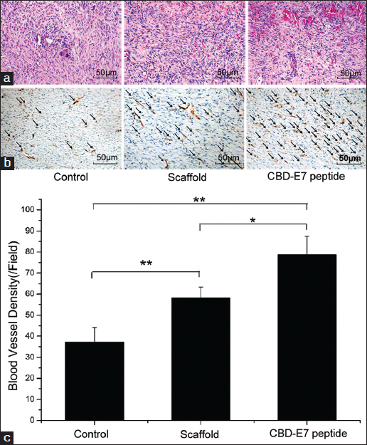 Hematoxylin and eosin (HE) and immunohistochemical (IHC) staining for capillary vessel formation in skin wounds 7 days after surgery (n = 6). (a) HE staining. (b) The degree of vascularization in the wound granulation tissues. The arrows indicate blood vessels. (c) The statistical analysis of the blood vessel density. The data are presented as the mean ± SD**P < 0.01. SD = standard deviation.