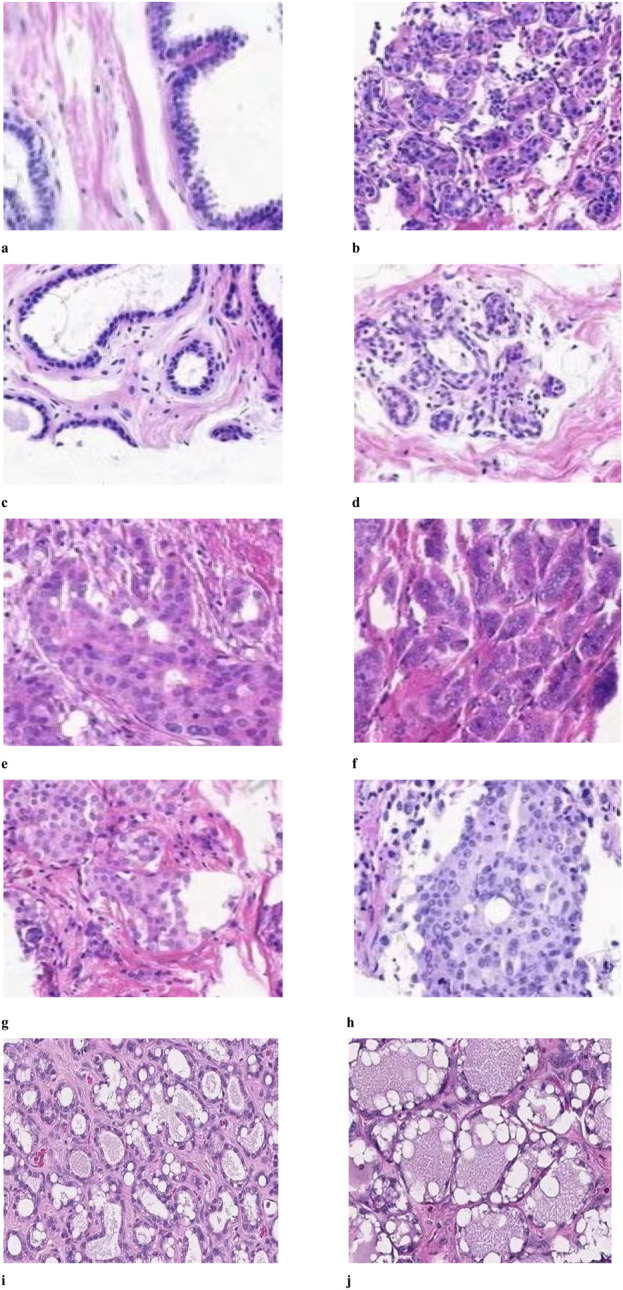 Histopathology of mammary tissue from rats in groups (A–J).