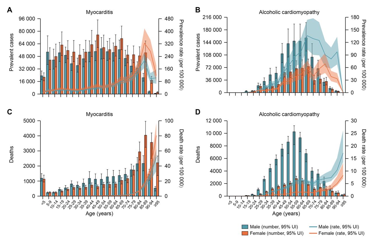 Age-specific numbers and rates of prevalent cases and deaths for myocarditis and alcoholic cardiomyopathy by sex, 2017(A) Age-specific numbers and rates of myocarditis prevalent cases; (B) Age-specific numbers and rates of alcoholic cardiomyopathy prevalent cases; (C) Age-specific numbers and rates of myocarditis deaths; (D) Age-specific numbers and rates of alcoholic cardiomyopathy deaths.