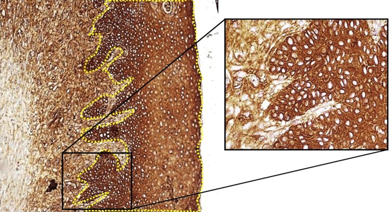 Pancytokeratin antibody-labeled section of tissue 21 days after burning from the NF group, showing complete epithelialization, 100× and 400×. NF, new formula.