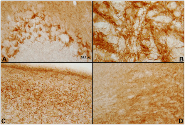 Different patterns of immunostaining of CB1 receptors in the hamster GASH/Sal brain. Immunostaining of CB1 receptors in the brain of GASH/Sal in which a representation of the different staining patterns shown in coronal sections of different brain areas. (A) Dot-like staining surrounding the Purkinje cells bodies of the cerebellum; (B) Network of fibers (reticular staining) in the globus pallidus nucleus; (C) Plexiform staining in the primary motor cortex; (D) Diffuse staining in the substantia nigra.