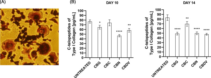 Effect of CBG, CBC, CBN, and CBDV on bone resorption. (A) Representative images of osteoclasts differentiated from THP‐1 cells (TRAP‐positive). Magnification 20×. (B) Effect of CBG, CBC, CBN, and CBDV on modulating the release of C‐terminal type I collagen fragments, from bovine bone slices, by osteoclasts. The release of C‐terminal type I collagen fragments was evaluated by ELISA. Results are the mean ± SD of three experiments. *p < 0.05, **p < 0.01, ****p < 0.0001 versus UNTREATED.