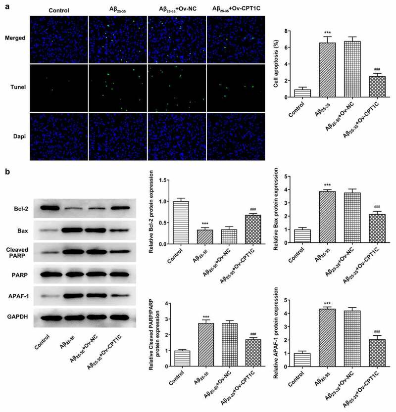 CPT1C overexpression decreased the apoptosis of Aβ25-35-induced HT22 cells. Following transfection of Ov-CPT1C or Ov-NC for 24 h, HT22 cells were treated with Aβ25–35 for another 24 h