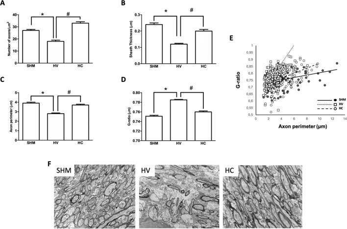 Myelin study in white matter by electron microscopy. Electron microscopy studies performed in the external capsula of the corpus callosum 30 days after a hypoxic-ischemic (HI) insult induced in P7–10 Wistar rats then receiving vehicle (HV) or cannabidiol (HC), or a similar period in control rats (SHM). (A) Number of axons (B) myelin sheath thickness (C) Axon perimeter (D) g-ratio (E) Dots and trend lines representing the relationship between axon size and g-ratio values (F) Representative micrographs. Bars represent mean ± SEM. Scale bar: 10 µm. *p < 0.05 vs SHM; #p < 0.05 vs HV, by ANOVA.
