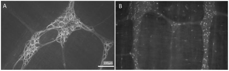 Appearance of enteric glial cells (EGCs). (A,B) are images obtained from the myenteric plexus of the rat distal colon; immunoreactivity to GFAP (A) and Sox-10 (B) are characteristic of EGCs. GFAP: glial fibrillary acidic protein. Images obtained by L.L.-G. (NeuGut-URJC).
