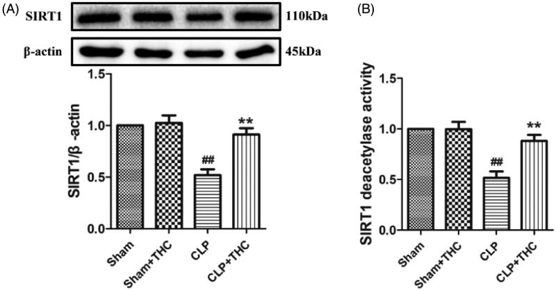 THC promoted the expression of SIRT1 in renal tissues in septic mice. (A) SIRT1 expression. (B) Relative SIRT1 activity. Data were presented as the mean ± SEM (n = 6 in each group). ##p< .01 vs. the Sham group, **p< .01 vs. the CLP group.
