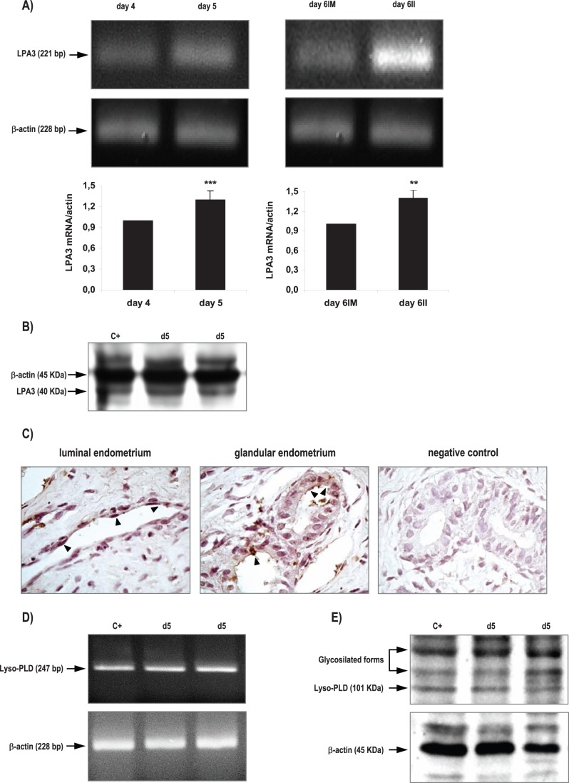Expression of LPA3 receptor and Lyso-PLD enzyme in the rat uterus during the window of implantation.LPA3 messenger (A) and protein (B) and Lyso-PLD messenger (D) and protein (E) were detected by RT-PCR and Western Blot. Also, LPA3 localization (C) was determined by immunhistochemistry in day 5. Black arrows indicate positive staining (200x). In A *** p<0.001 day 4 vs day 5, ** p<0,01 day 6IM vs day 6II. Results are shown as means ± sem. N = 4–6 for each point. d5: uterus from rats pregnant on day 5 of gestation; IM: implantation sites; II: inter-implantation sites.