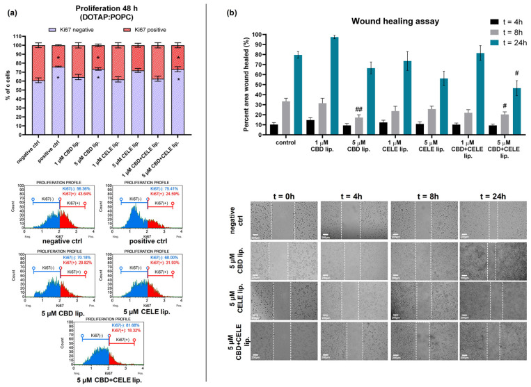 Proliferation marker Ki67 profile (a) was assessed in U-87 MG cell line treated with CBD, CELE, and their combinations loaded in DOTAP:POPC liposomes for 48 h using the Muse® Ki67 Proliferation Kit. Non-treated cells and topotecan (1 µM) served as negative and positive controls, respectively. An asterisk (*) indicates values significantly different from the untreated control cells with p < 0.05. Representative histograms are also presented. The inhibition of the migratory potential of U-87 MG cells (b) as a result of treatment with CBD, CELE and their combinations loaded in DOTAP:POPC liposomes for 48 h was demonstrated using a wound-healing assay performed after 4, 8, and 24 h. Representative images of the wound-healing assay for control cells and cells treated with drug combinations are also presented (scale bar 200 µm). Data were pooled from two independent experiments with four measurements per assay. The results at each time point were statistically evaluated relative to the non-treated control. Single hashtag (#) and double hashtag (##) indicate values significantly different from the non-treated control at the same time point with p < 0.05 and p < 0.01, respectively.