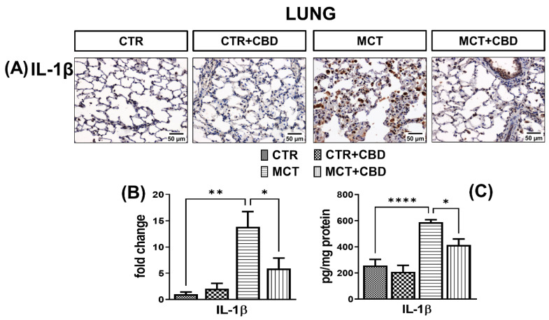 The influence of monocrotaline (MCT)-induced pulmonary hypertension and cannabidiol (CBD) or its vehicle on interleukin-1β (IL-1β) (A); representative micrographs of immunohistochemical staining (magnification 200×) (B) and their quantification; (C) the concentration of IL-1β determined by enzyme-linked immunosorbent assay (ELISA) in rats’ lungs. Bar graphs (B,C) illustrate the fold changes (for the relative fold change in expression in comparison to the respective CTR, whose expression level was set to 1) in the percentage area stained for IL-1β and concentration of IL-1β, respectively. The dark brown precipitate represents the intensity of IL-1β. CBD (10 mg/kg) or its vehicle was injected i.p. every 24 h for 21 days. Data are presented as mean ± SEM, (n = 6–7 per group); * p < 0.05, ** p < 0.01, and **** p < 0.0001, compared to the respective group.