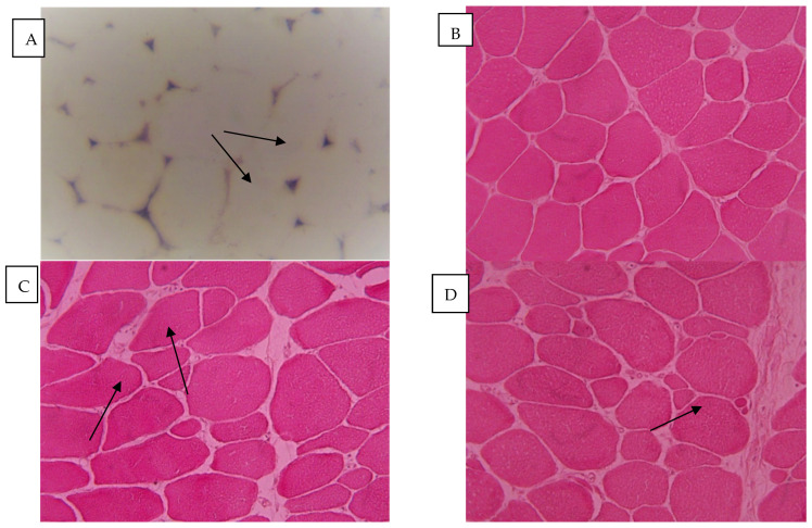 (A) Capillaries (arrows); alkaline phosphatase staining; magnification ×200. (B) Normal structure of superficial breast muscle. (C) Split fibers (arrows). (D) Atrophic fibers (arrow). (E) Necrosis (N). (E) Giant fiber (GF). (B–F) hematoxylin and eosin (HE) staining; magnification ×200.