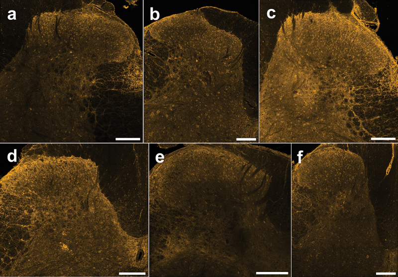 Immunoreactivity of the CB1 receptor in lumbar spinal cord sections from female rats. (A)–(F) Representative confocal images (20× objective) of CB1 immunostaining from each female rat (n = 6) showing neuropil staining that is especially pronounced in the SDH and cellular staining across the DH. Scale bar = 200 µm.