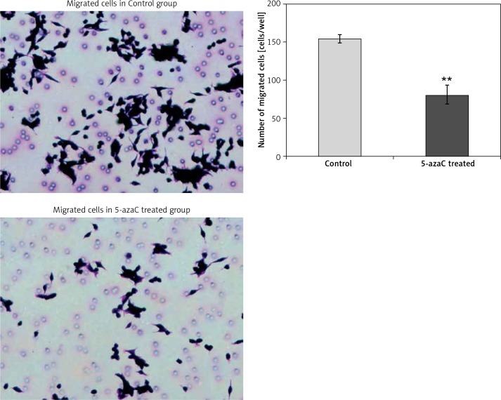 Migration of colon cancer cells treated with 5-azaC. Treatment of SW620 cells with 5-azaC for 96 h significantly decreased their migration ability (79.83 ±9.50 cells/well) when compared to the migration of untreated SW620 cells (154.33 ±17.48 cells/well; t = 8.18; p = 0.001)**p < 0.01 (5-azaC treated vs. Control).