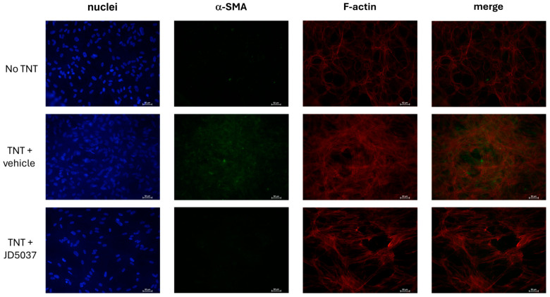 The effects of JD5037 on α-SMA expression in F-actin stress fibers of transdifferentiated human RPE cells. Representative images of immunostaining of nuclei (blue), F-actin stress fibers (red), α-SMA (green), and their co-expression (orange/yellow in the merged images) are shown. Primary cultured human RPE cells were plated on collagen gels and treated with the vehicle or JD5037, plus TNT (10 ng/mL) for 72 h. The collagen gels were fixed on the slide and immunostained for F-actin stress fibers with CF583R-labeled phalloidin, and α-SMA with an Alexa Fluor 488-labeled anti-α-SMA antibody.