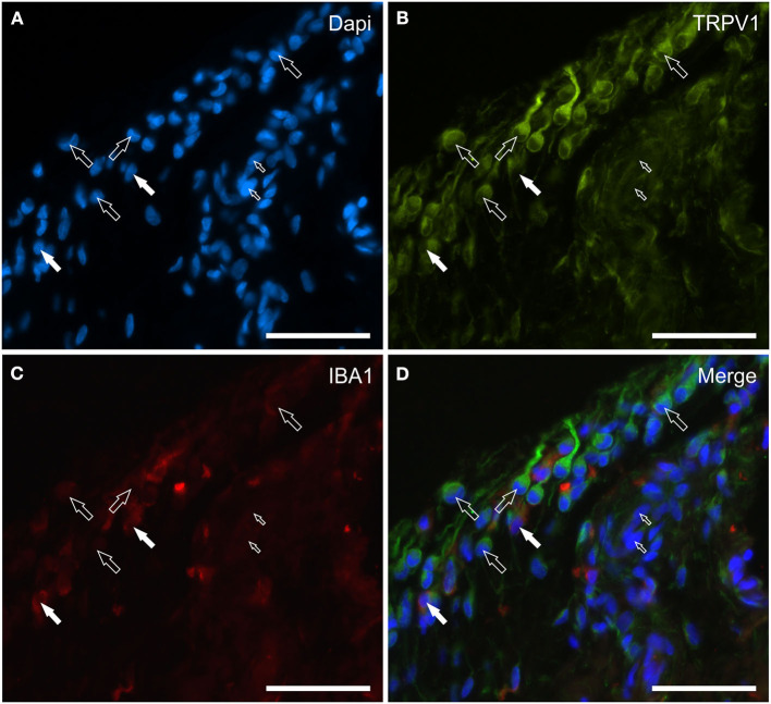 Photomicrographs of the cryosections of the synovial membrane of a horse metacarpophalangeal joint showing transient receptor potential vanilloid 1 (TRPV1) (B) and IBA1 (C) immunoreactivity. Both of the two cell types lining the synovial intima, i.e., the fibroblast-like synoviocytes (FLS) and the macrophage-like synoviocytes (MLS), showed bright TRPV1 (Green) immunoreactivity. The TRPV1 immunolabeling was also evident in the elongated cellular process of the FLS extending through the joint cavity. The white arrows indicate the DAPI (Blue) labeled nuclei (A) of two IBA1 (Red) immunoreactive MLS co-expressing bright TRPV1 (B) and moderate IBA1 (C) immunoreactivity. The open arrows indicate some round or elongated FLS which were TRPV1 immunoreactive and IBA1 negative. The small open arrows indicate the DAPI labeled nuclei of the endothelial cells showing moderate TRPV1 immunoreactivity. (D) Merged image (Orange). Scale bar = 50 μm.