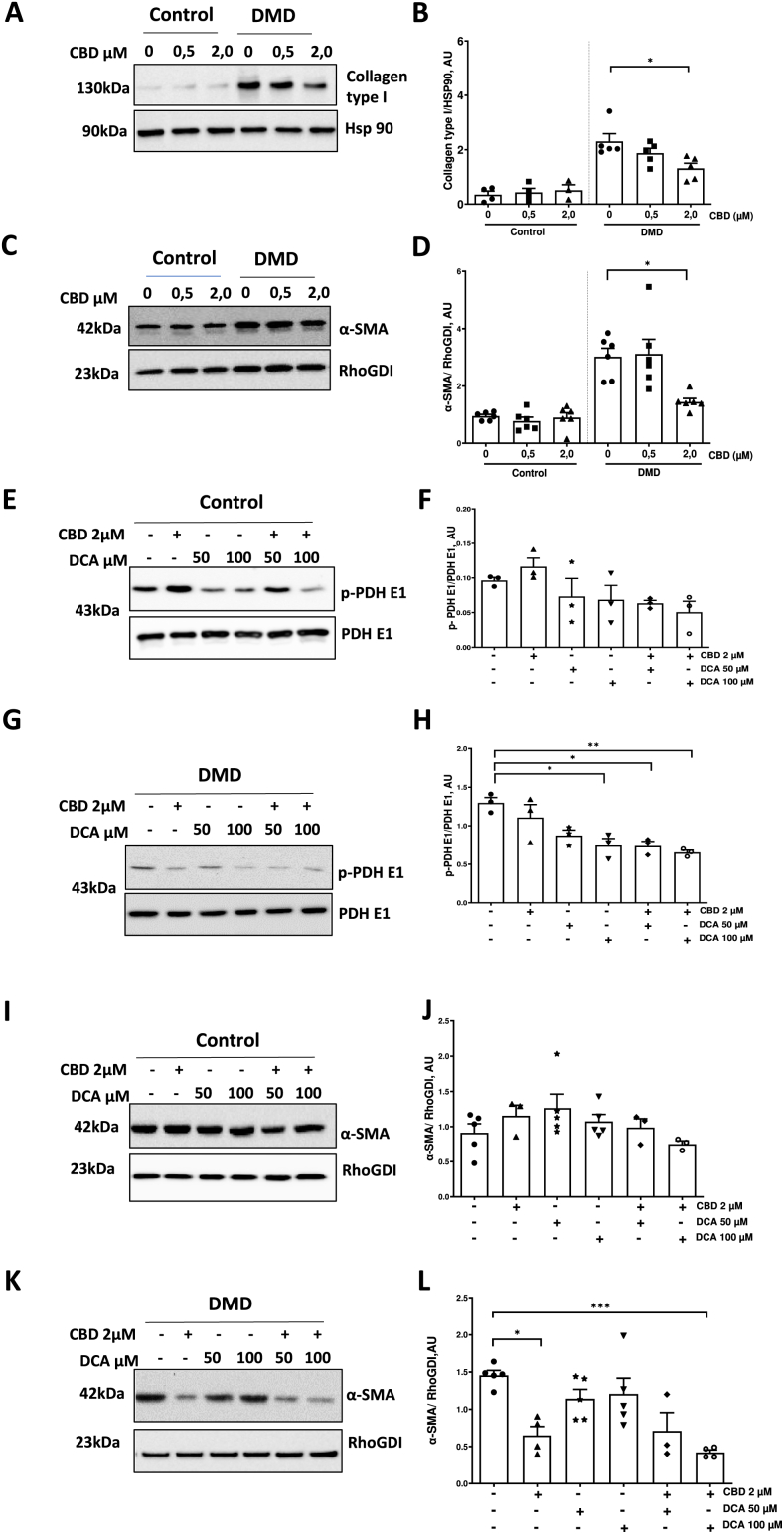 Effects of CBD and dichloroacetate (DCA) on fibrotic and metabolic protein markers in hiPSC-cFib.(A–B) Representative western blots and quantification of collagen type I and α-smooth muscle actin (α-SMA) (C–D) in hiPSC-cFib derived from healthy controls and DMD patients treated with CBD (0.5–2 μM, 24 h). Data are presented as mean ± SEM from n = 3 healthy donors and n = 3 DMD patients, with technical replicate derived from independent hiPSC-cFib differentiation batches performed on each biological sample. Statistical differences between treatments in control and DMD groups were determined using a non-parametric one-way ANOVA. P < 0.05 was considered statistically significant.(E–H) Representative western blots and quantification of p-PDH E1 and total PDH E1 in hiPSC-cFib derived from healthy controls (E–F) and DMD patients (G–H) treated with CBD (2 μM) and DCA (50–100 μM, 24 h). Data are presented as mean ± SEM from n = 3 healthy donors and n = 3 DMD patients. Statistical differences between treatments in control and DMD groups were determined using a non-parametric one-way ANOVA. *P < 0.05, **P < 0.01.(I–L) Representative western blots and quantification of α-SMA in hiPSC-cFib derived from healthy controls (I–J) and DMD patients (K–L) treated with CBD (2 μM) and DCA (50–100 μM, 24 h). Data are presented as mean ± SEM from n = 3 healthy donors and n = 3 DMD patients, with technical replicate obtained from independent hiPSC-cFib differentiation batches. Statistical differences between treatments in control and DMD groups were determined using a non-parametric one-way ANOVA. *P < 0.05, ***P < 0.001.