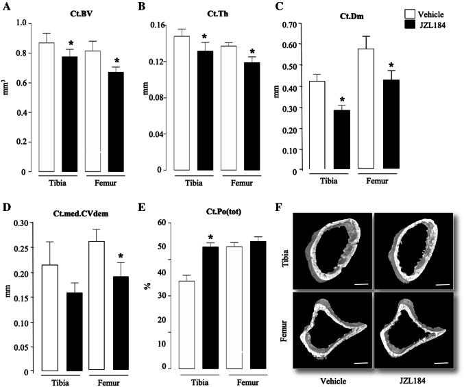 JZL184 induces cortical bone loss in mice bearing MM. Cortical bone parameters at the tibial and femoral metaphysis of 8-week-old adult C57BL/6KalWRij mice treated with vehicle (0.01% DMSO) (n = 8) or JZL184 (16 mg/kg, thrice-weekly) (n = 8) for 21 days post injection of mouse 5TGM1-GFP MM cells (106 cells/mouse). Cortical bone volume (Ct.BV, panel a), cortical thickness (Ct.Th, panel b), cortical diameter (Ct.Dm, panel c), medullary cavity diameter (CtmedCVdem, panel d) and cortical porosity (Ct.Po(tot), panel e) were assessed by microCT. f Representative microCT images of cortical bone from tibiae and femur of the mice described in panels a–e (scale bar = 1 mm). Values are mean ± SD; *p < 0.05 versus vehicle