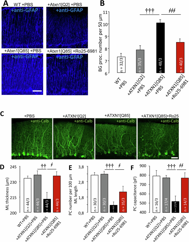 Long-term Ro25-6981 administration reduces neurodegeneration in the cerebellar cortex of ATXN1[Q85]-expressing mice.A Anti-GFAP staining reveals reactive BG morphology in SCA1 model mice. Representative images are shown. Scale bar: 50 μm. B Mean ± SEM number of BG processes per 50 μm of length (PATXN1[Q2]/ATXN1[Q85] = 1.83 ×10⁻⁶; PATXN1[Q85]+PBS/ATXN1[Q85]+Ro25-6981 = 7.58 × 10⁻⁵; one-way ANOVA with Tukey HSD post hoc). C Anti-calbindin staining visualizes PC morphology. Scale bar: 50 μm. D Graph showing the mean ± SEM thickness of the ML in μm (PATXN1[Q2]/ATXN1[Q85] = 0.009; PATXN1[Q85]+PBS/ATXN1[Q85]+Ro25-6981 = 0.023; one-way ANOVA with Tukey HSD post hoc). E Graph showing the mean ± SEM number of PCs per 100 μm (PATXN1[Q2]/ATXN1[Q85] = 2.7 ×10⁻⁶; PATXN1[Q85]+PBS/ATXN1[Q85]+Ro25-6981 = 0.046; one-way ANOVA with Tukey HSD post hoc). n = number of examined areas/animals. Statistical significance was determined using one-way ANOVA. * – p < 0.05 between ATXN1[Q2]- and ATXN1[Q85]-expressing mice. F PC capacitances in various groups (PATXN1[Q2]/ATXN1[Q85] = 0.0004; PATXN1[Q85]+PBS/ATXN1[Q85]+Ro25-6981 = 0.0043; one-way ANOVA with TukeyHSD post hoc). † – significant difference between ATXN1[Q2]-expressing and untreated ATXN1[Q85]-expressing mice. ҂ – significant difference between untreated ATXN1[Q85] mice and ATXN1[Q85] mice treated with long-term Ro25-6981. ҂p < 0.05, ҂҂, ††p < 0.01, and ҂҂҂, †††p < 0.001.