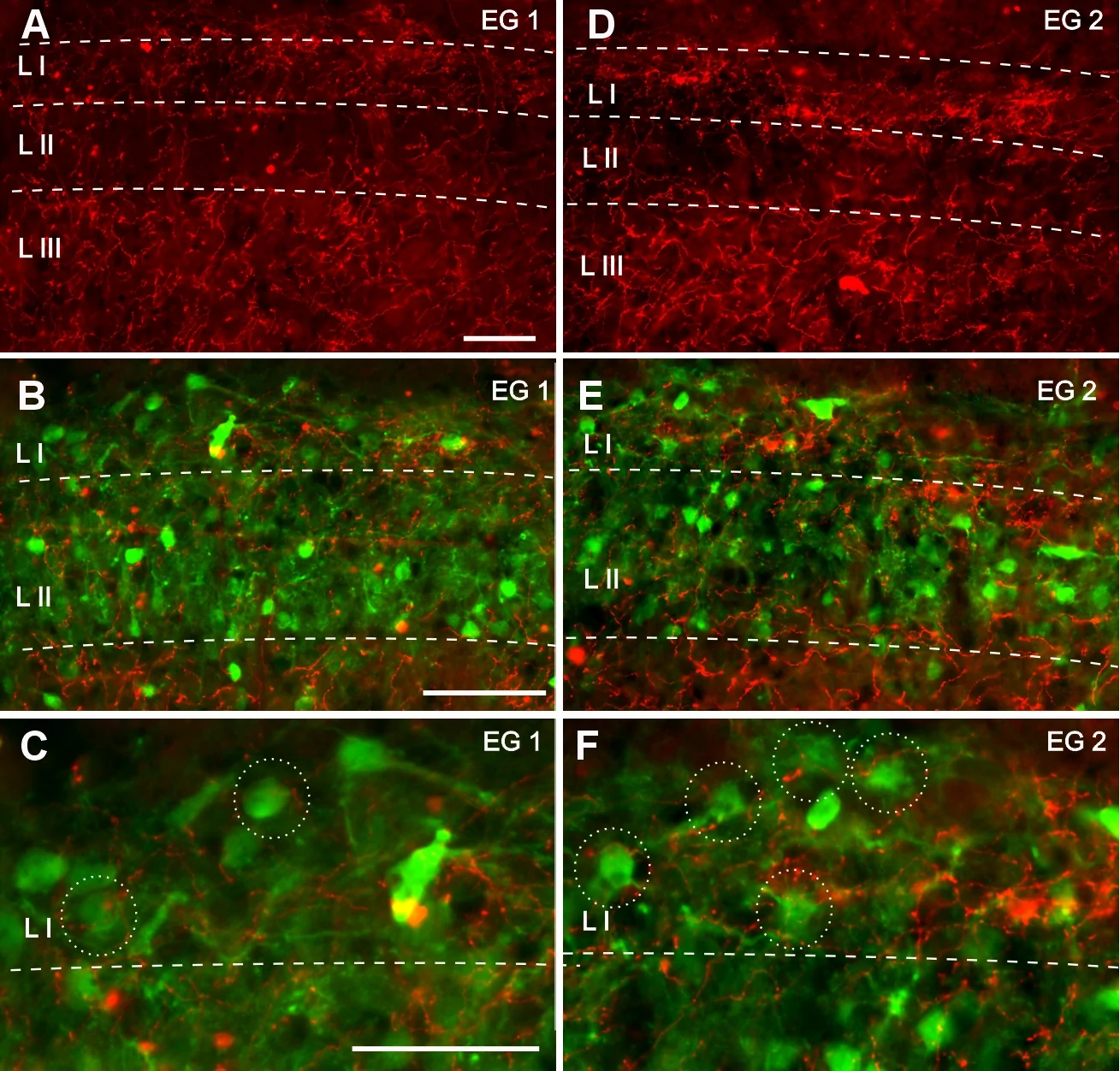 Analysis of the 5HT-T in the laminae of the ipsilateral Vc to molar pulpitis (A and D). The length of the plexus (G) and the quantification of its varicosities (H) in superficial laminae (LI and LII) and deeper lamina (LIII) are represented in the bar graphs for CG, EG1 and EG2. B-C and E-F show the co-expression of calbindin D28K (FITC) and 5HT-T varicosities (rhodamine). The table (I) presents the mean percentage + SEM of calbindin D28K neurons with 5HT-T varicosities around the soma for each lamina of the Vc in all groups. The scale bar represents 50 μm. * p<0.05