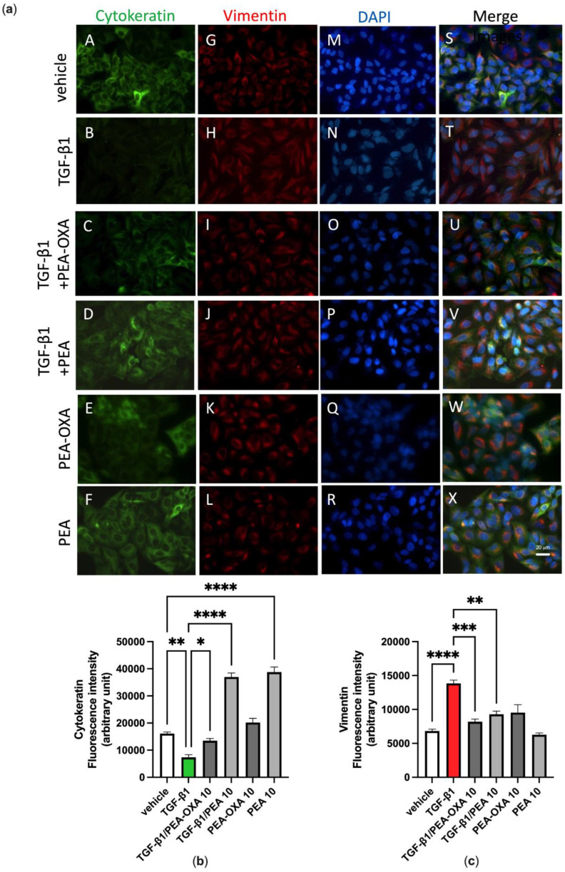 TGF-β1-induced epithelial–mesenchymal transition in A549 cells as evidenced by immunofluorescence approaches is avoided by the treatment with PEA-OXA or PEA. (a) Immunofluorescence staining was examined for the following markers: cytokeratin, an epithelial marker (green fluorescence, panels A–F), and vimentin, a mesenchymal marker (red fluorescence, panels G–L). DAPI staining was included to visualize the cell nucleus (blue fluorescence, panels M–R). In the merged images the co-expression and co-distribution of the markers are visualized (panels S–X). Quantifications of cytokeratin (b) and vimentin (c). The cells were captured with a 40 × microscope objective (Bar = 20 µm). Each bar shows the mean ± SEM of independent experiments (n = 3). The p-values were determined by ANOVA followed by Tukey’s multiple comparisons test. **** p < 0.0001, *** p < 0.001, ** p < 0.01 and * p < 0.05.